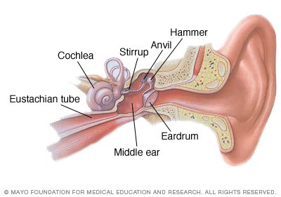 اسباب التهاب الأذن الوسطى الحاد
