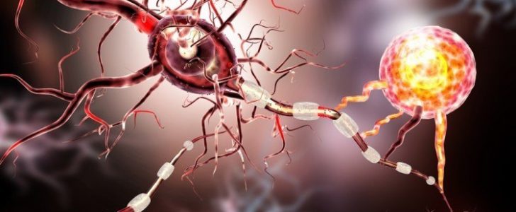التهاب الاعصاب وطرق علاجه