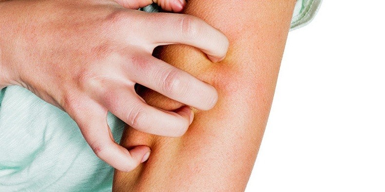 علاج حساسية الجلد نهائيا