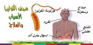 أعراض الكوليرا وتاريخها وعلاجها وطرق الوقاية منها