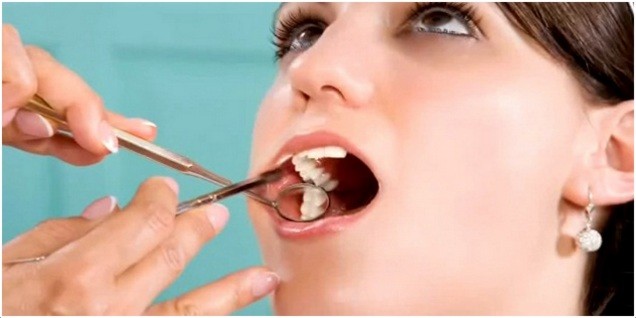 علاج الام الاسنان بالاعشاب