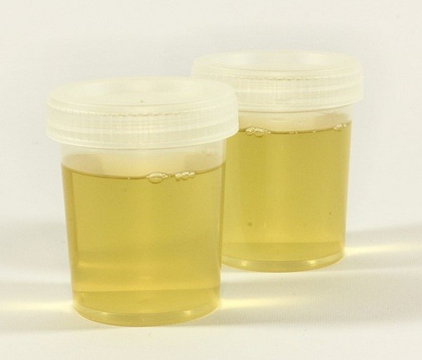 طرق لعلاج الصديد في البول طبيعياً