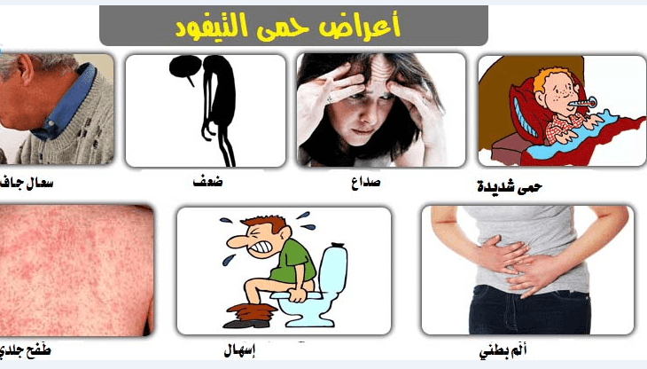 التيفود اعراضه وعلاجه