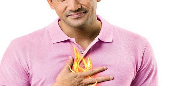 علاج الحرقان الصدري