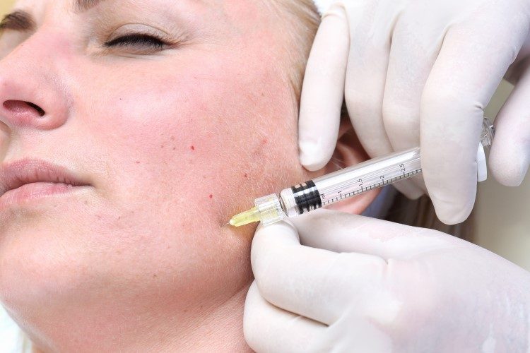 أضرار التبييض: 4 أضرار ستجعلك تبتعدين عنه تماماً