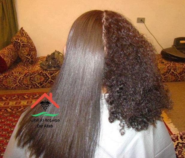 اضرار الكرياتين