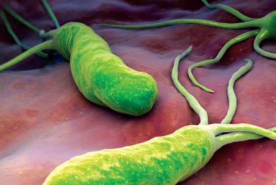 Photo of الميكروب السبحي ، أعراضه وطرق الوقاية منه