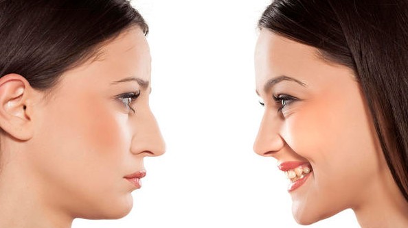 عملية تجميل الانف بدون جراحة