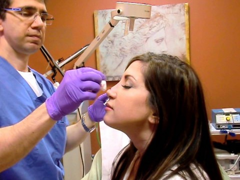 عملية تجميل الانف بدون جراحة