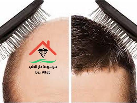 زراعة الشعر في مصر