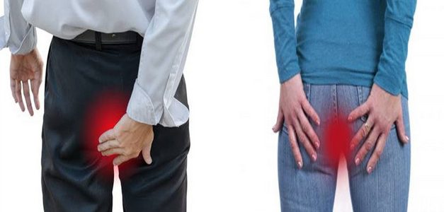 التهاب فتحة الشرج أسبابه وعلاجه