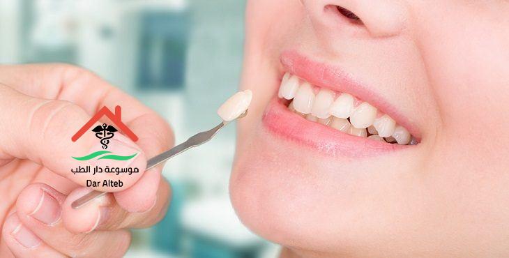 Photo of تركيبات الأسنان الإيماكس