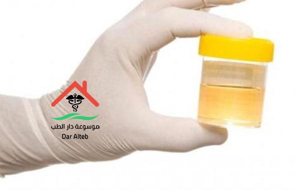طرق علاج حرقان البول