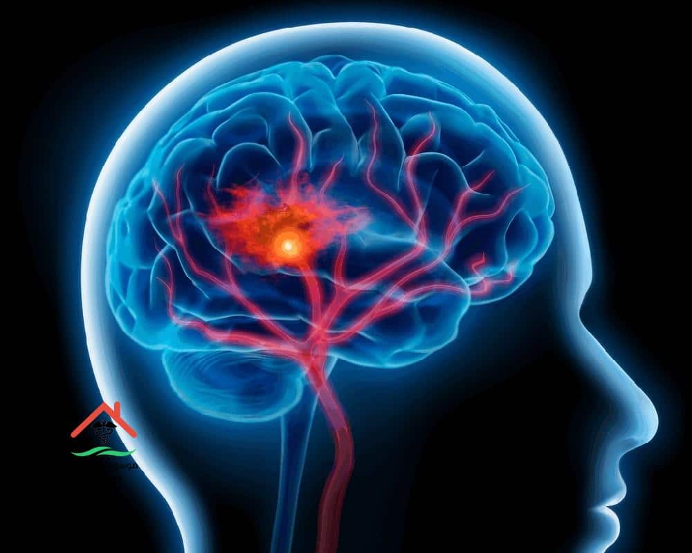 اعراض زيادة كهرباء المخ