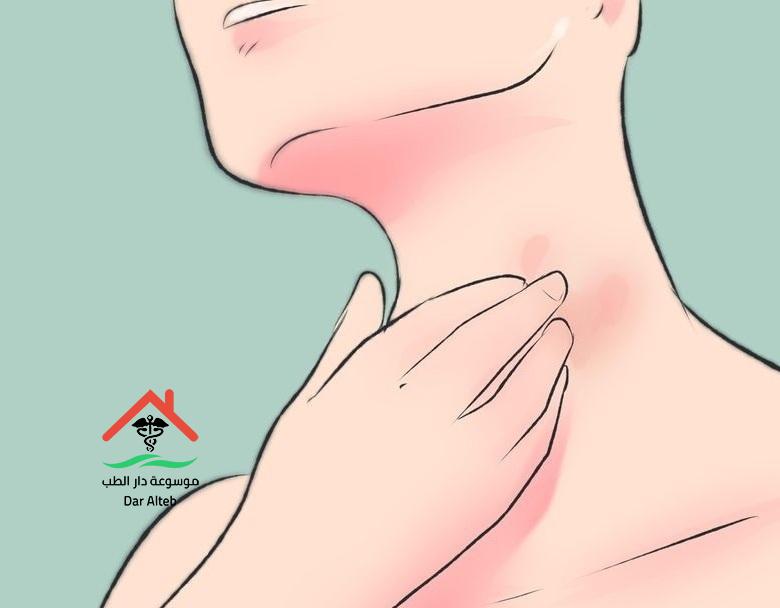 علاج الم الزور والحلق