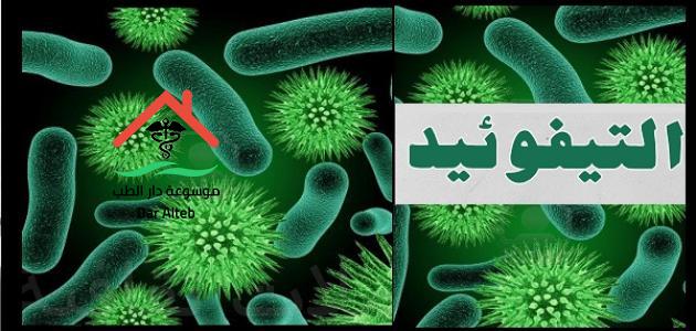 مرض التيفود اسبابه اعراضه وعلاجه