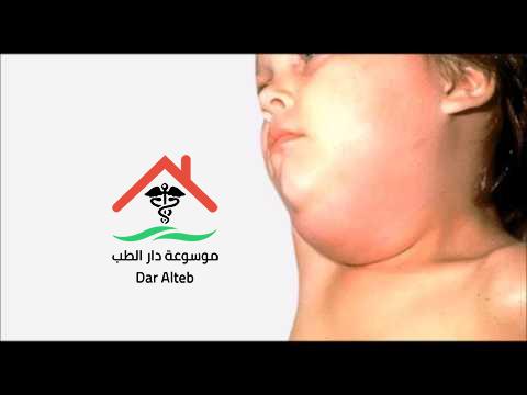 ابو اللكيم وطريقة التعامل معه