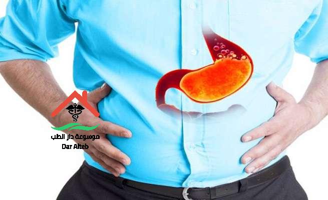 أسرع علاج للحموضة بوصفات منزلية بسيطة فعالة بشكل كبير موسوعة دار الطب